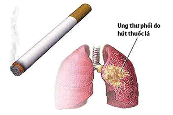 HÚT THUỐC LÁ CÓ HẠI NHƯ THẾ NÀO?