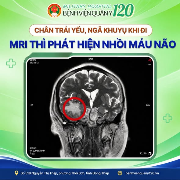 CHÂN TRÁI YẾU, ĐI LẠI NGÃ KHUỴU – ĐỪNG NGHĨ CHỈ LÀ TUỔI GIÀ